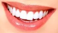 دلایل ایجاد لکه‌های سفید روی دندان‌ها چیست؟