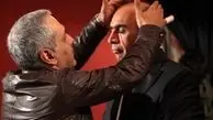 ماجرای عجیب و واقعیِ قطع شدن انگشت مهران مدیری در برنامه معروف! + عگس