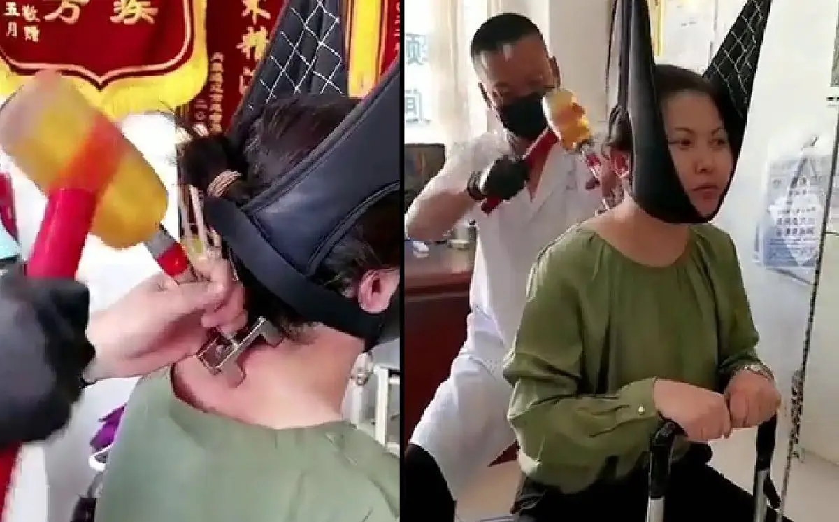 ویدئوی باورنکردنی از درمان عجیب مهره‌های گردن در چین