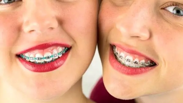 ویدئویی جالب از مراحل عصب‌کشی دندان