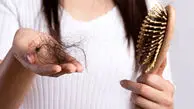 عوامل مهم در ریزش مو را بشناسید + درمان ریزش مو در خانه