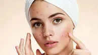 ۱۰ راز برای داشتن پوستی سالم و زیبا