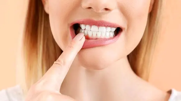 ترفندهای ساده برای تسکین فوری دندان درد در خانه