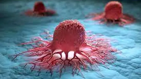 نشانه‌هایی که از سرطان تیروئید خبر می‌دهد را جدی بگیرید