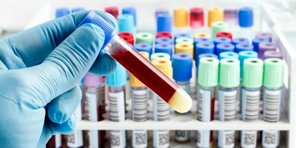 چرا آزمایش خون می‌دهیم؟ برای چه کاری استفاده می‌شود؟