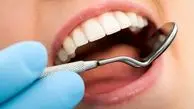راهکارهایی برای مراقبت از مینای دندان