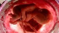 مراحل شکل‌گیری جنین در رحم مادر + ویدپو