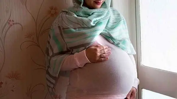  ماجرای عجیب «جنین سنگی» در بدن زن ۵۲ ساله ایرانی!
